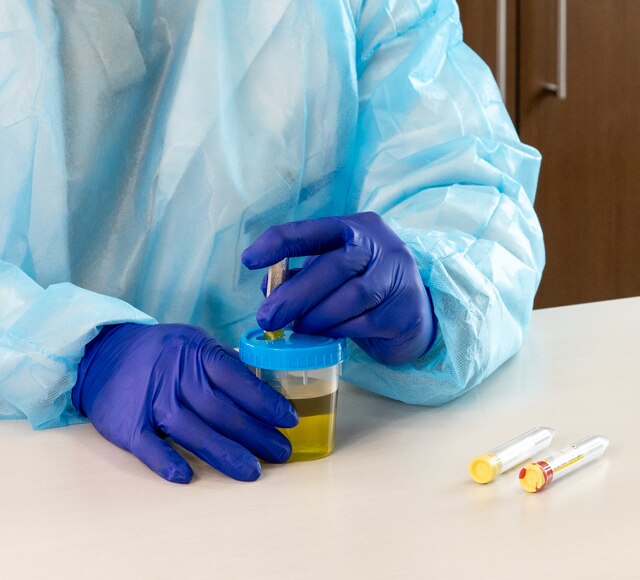 Urine collection from lab personal