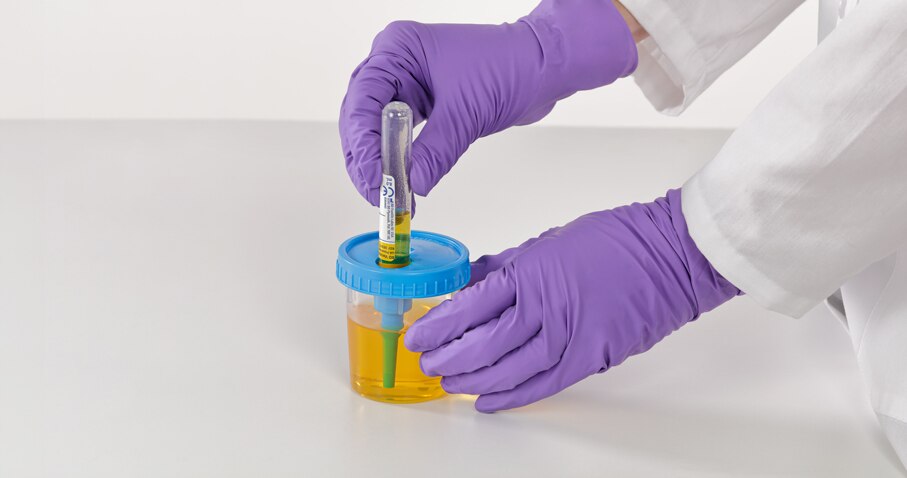 fy24_ids_bdvacutainer-urine-collection-kit-header