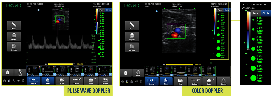 Vascular assessment