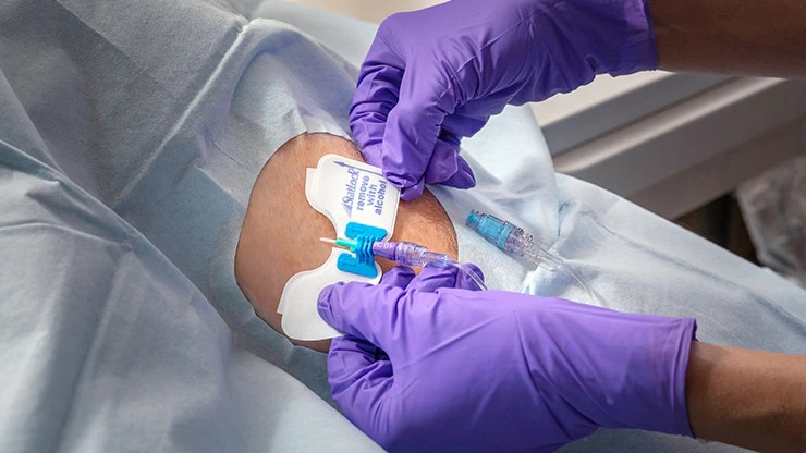 <h3>SECURE the catheter</h3>
<p>Secure the position of the catheter at the site to reduce the risk of dislodgment. Using adhesive-based ESDs or device stabilization devices that may reduce risk of infection and catheter dislodgment.<sup>2*</sup></p>
<p><sup>2*. Infusion Nurses Society. Infusion Therapy Standards of Practice. J Infus Nurs. 2016; 39(1S): S73.</sup></p>
<p><a href="/content/bd-com/ga/in/en-in/products-and-solutions/solutions/vascular-access-management.html#Partner" title="Link to form on Partner with BD page"><span class="forward-arrow-icon-boosted-blue">Let us help identify the gaps in your clinical practice</span></a></p>
