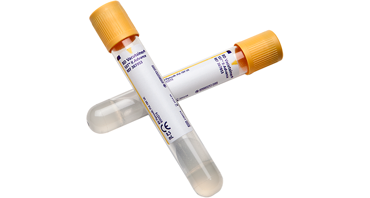 vacutainer-blood-tubes_sst