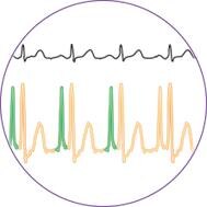 ecg-in-circle.jpg